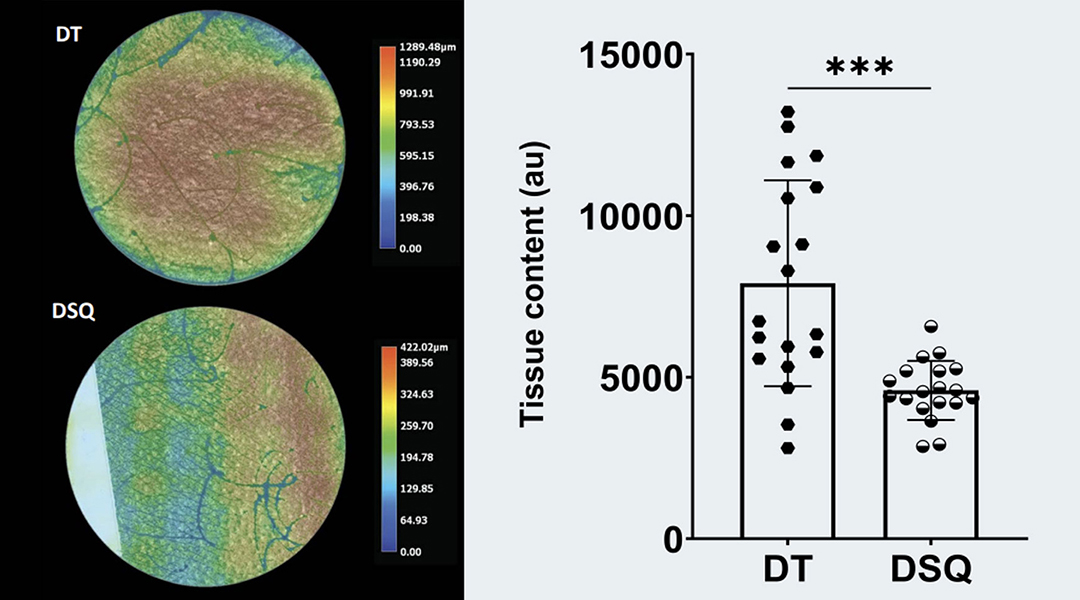 Figure 2 (continued). Epidermal tissue content on Smart Sticker (DT) and D-squame (DSQ) tapes